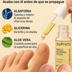 JoyPretty™ ¡Elimina los hongos de tus uñas de raíz!