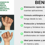 JoyPretty™ ¡Elimina los hongos de tus uñas de raíz!