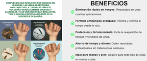 JoyPretty™ ¡Elimina los hongos de tus uñas de raíz!