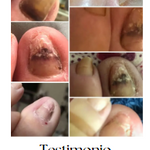 JoyPretty™ ¡Elimina los hongos de tus uñas de raíz!