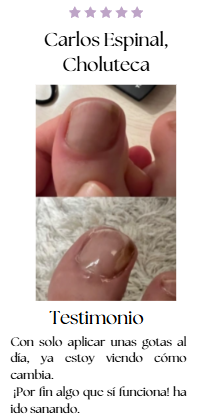 JoyPretty™ ¡Elimina los hongos de tus uñas de raíz!