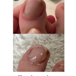 JoyPretty™ ¡Elimina los hongos de tus uñas de raíz!